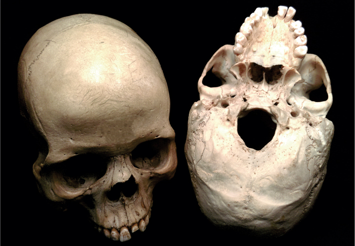 Trenches human skulls