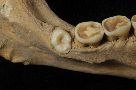 Atapuerca Neolithic teeth
