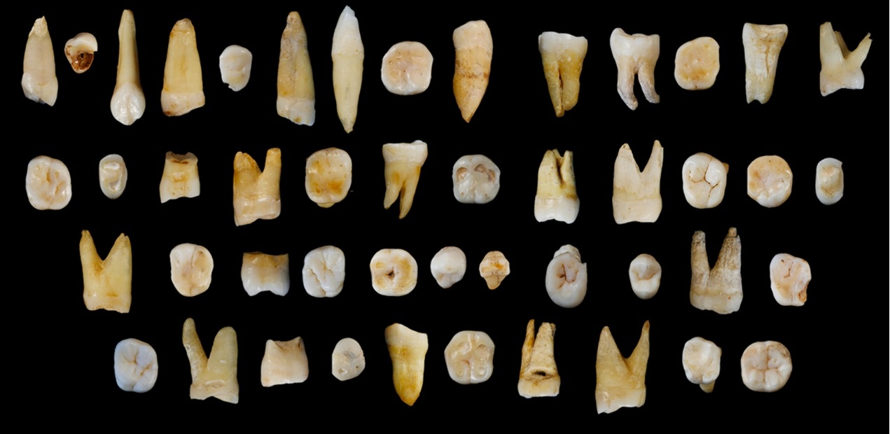 China Cave Human Teeth