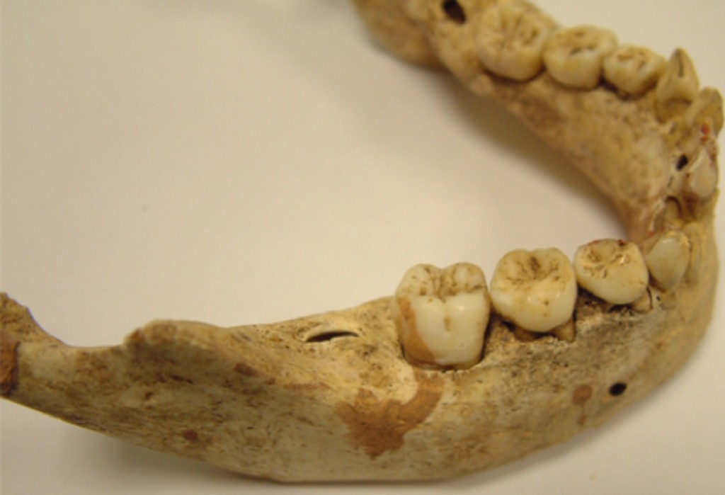 Canterbury medieval teeth