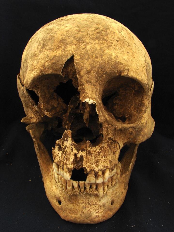 Rome migrant skull