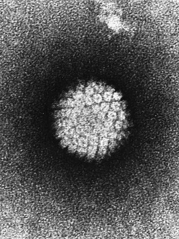 HPV virus infection