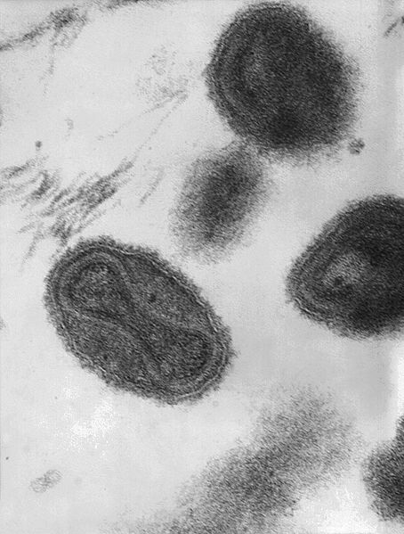 Lithuania smallpox virus