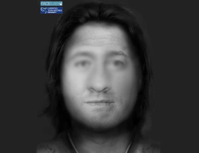 Derbyshire facial reconstruction