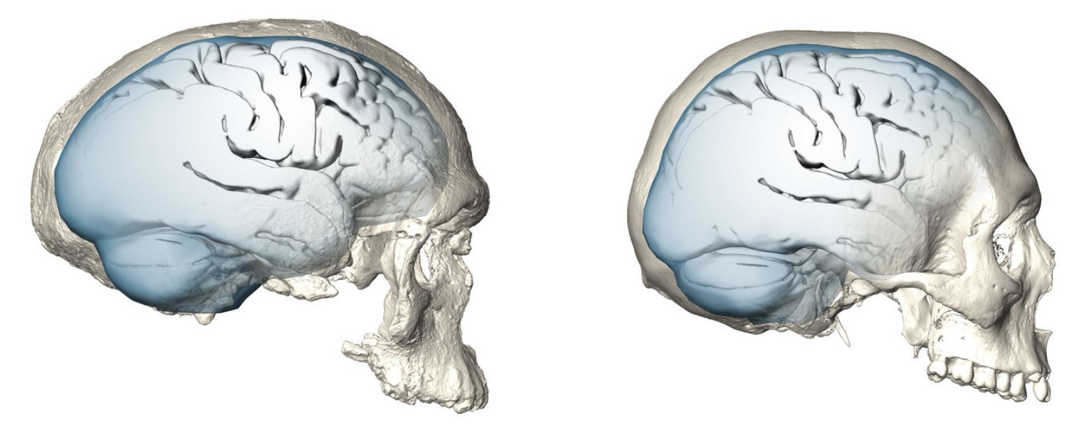 human brain case