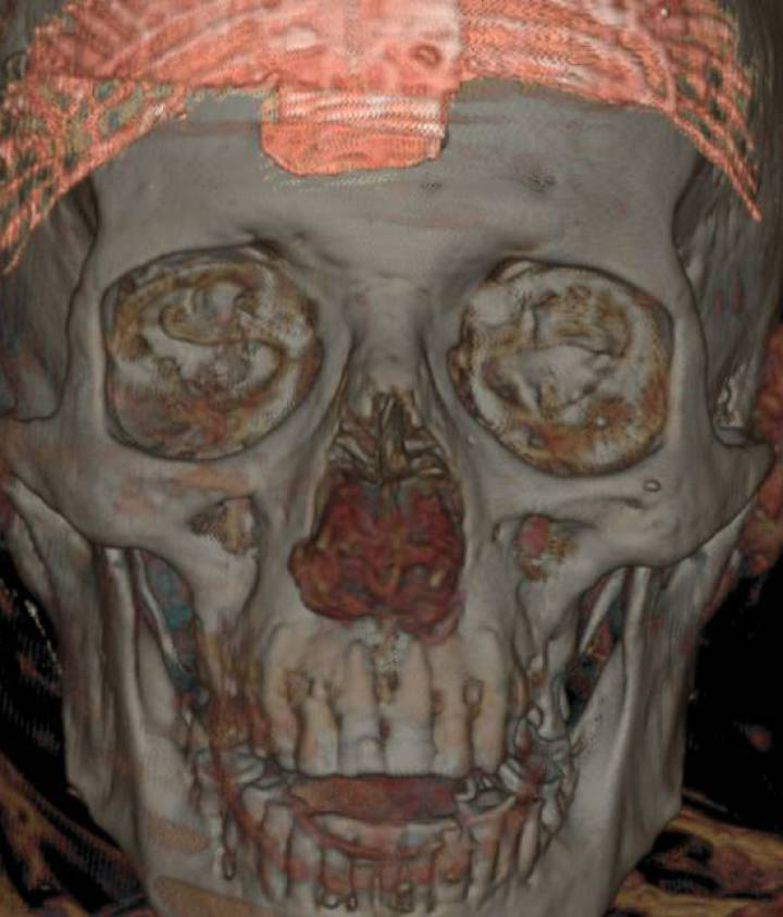 Egypt Mummy CT Scan