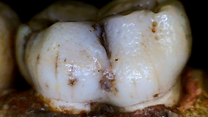 Paranthropus robustus teeth