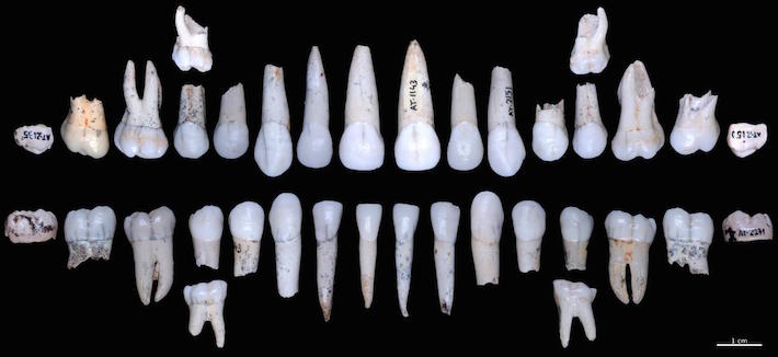 Spain Hominin Teeth