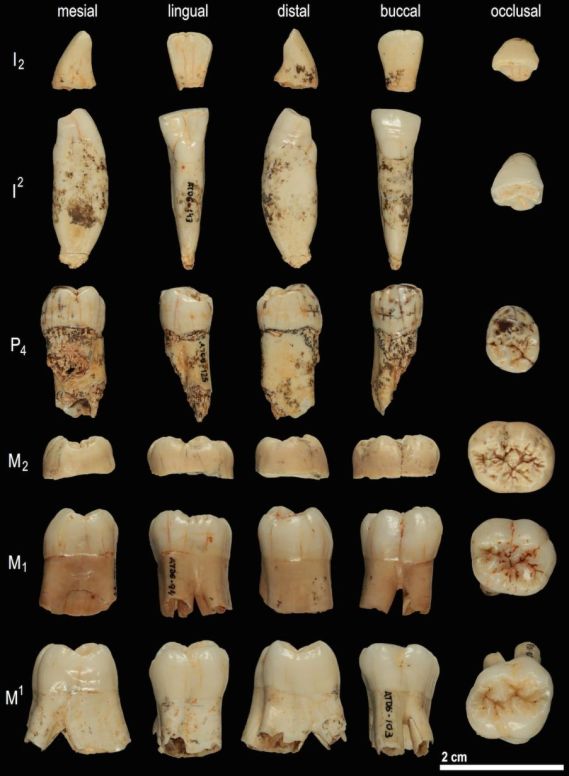 Homo Antecessor Tooth