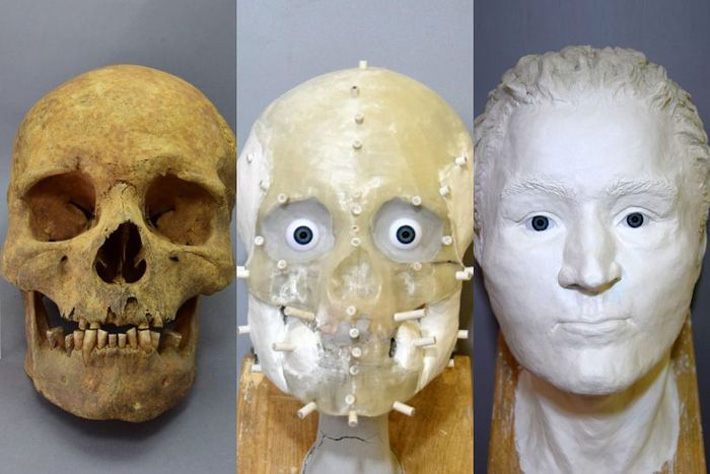 Poland Facial Reconstruction
