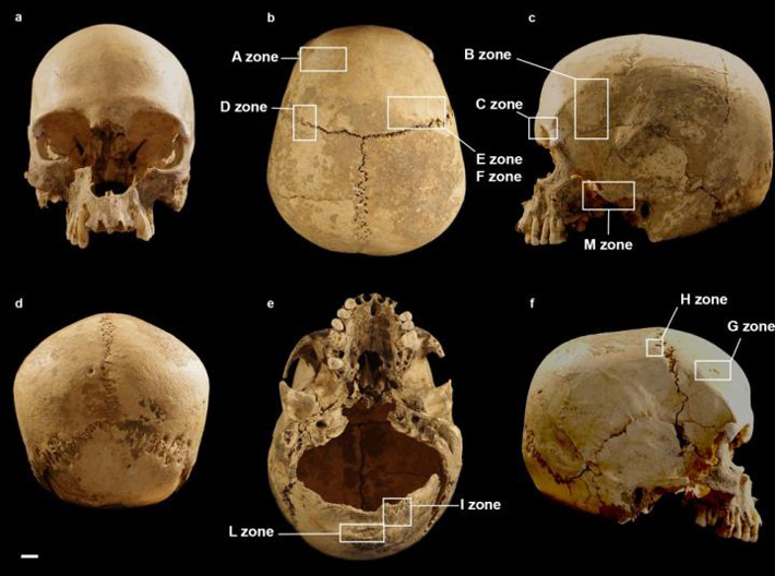 Italy Neolithic Skull
