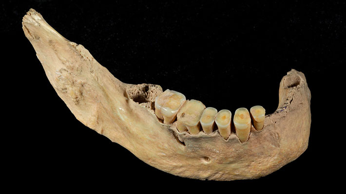 China Human Jawbone