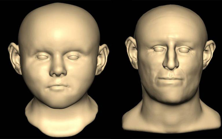 England Facial Reconstructions