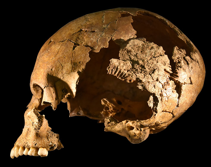 Germany Medieval Skull