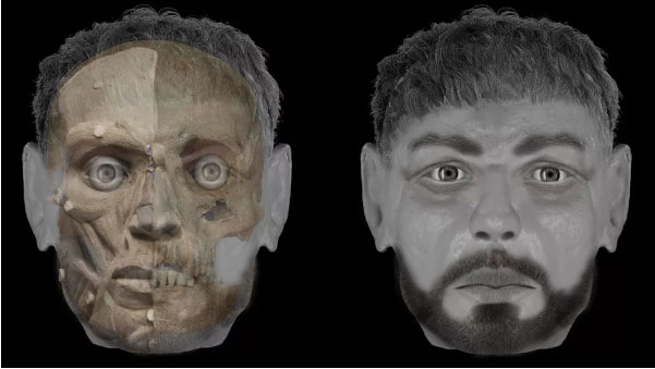 Italy Facial Reconstruction