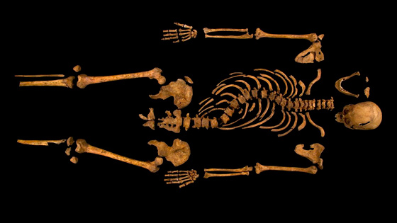 The almost fully intact skeleton shows that Richard III would have measured five-foot-eight-inches tall, a large man for the medieval era, though his spine shows he suffered from severe scoliosis. (Courtesy University of Leicester)