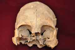 World Roundup Bolivia Tiwanaku Skull