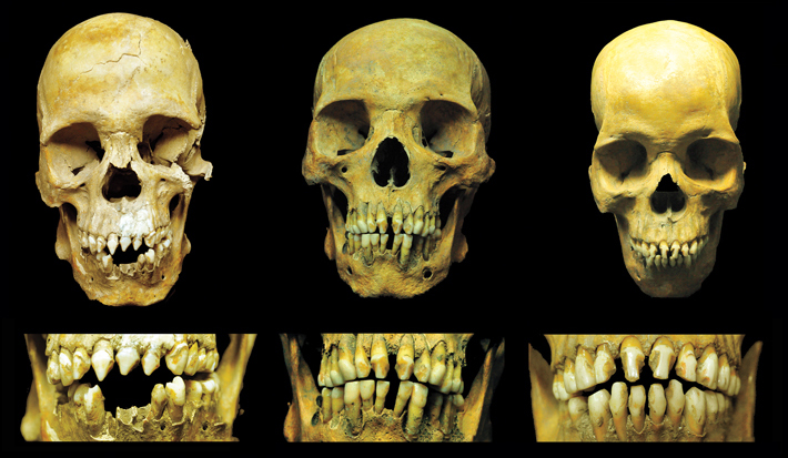 Top Ten Mexico City Skulls Teeth Combo