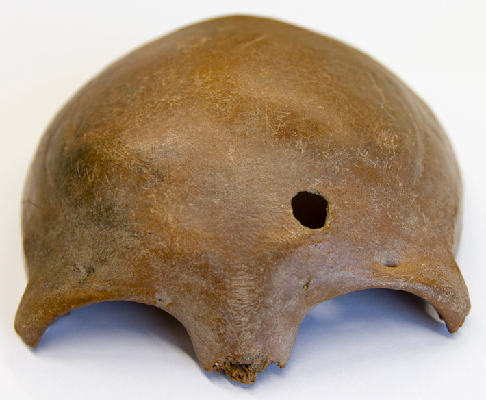 Trenches Netherlands Skull Fragment