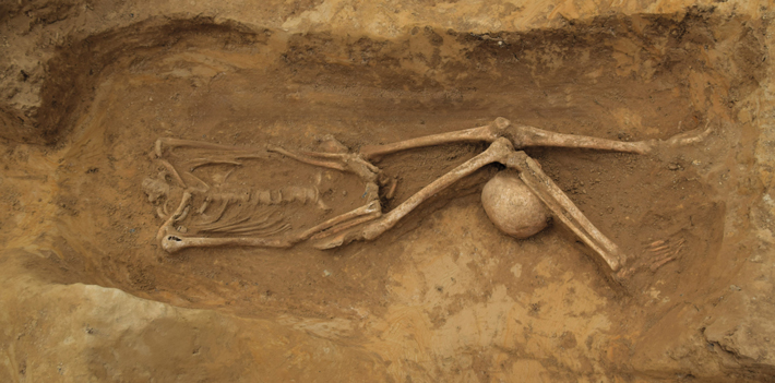 Trenches England Beheaded Skeleton