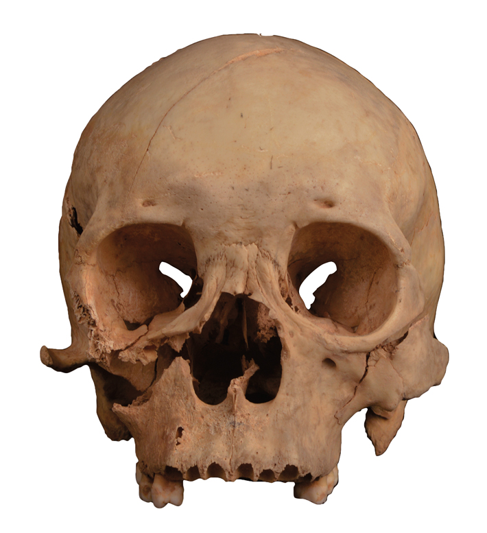 MA22 Digs China Skull Revised AGAIN