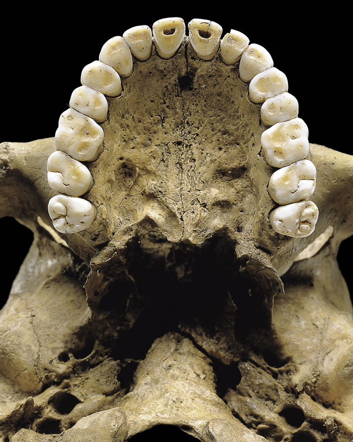 Germany Mesolithic Shaman Teeth