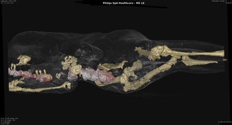 Pompeii CT scans