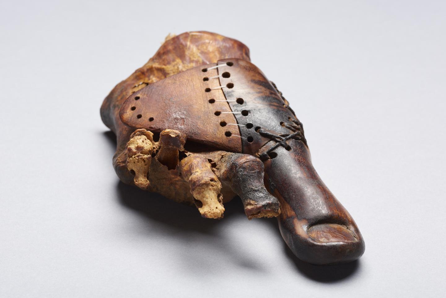 Egypt prosthetic toe