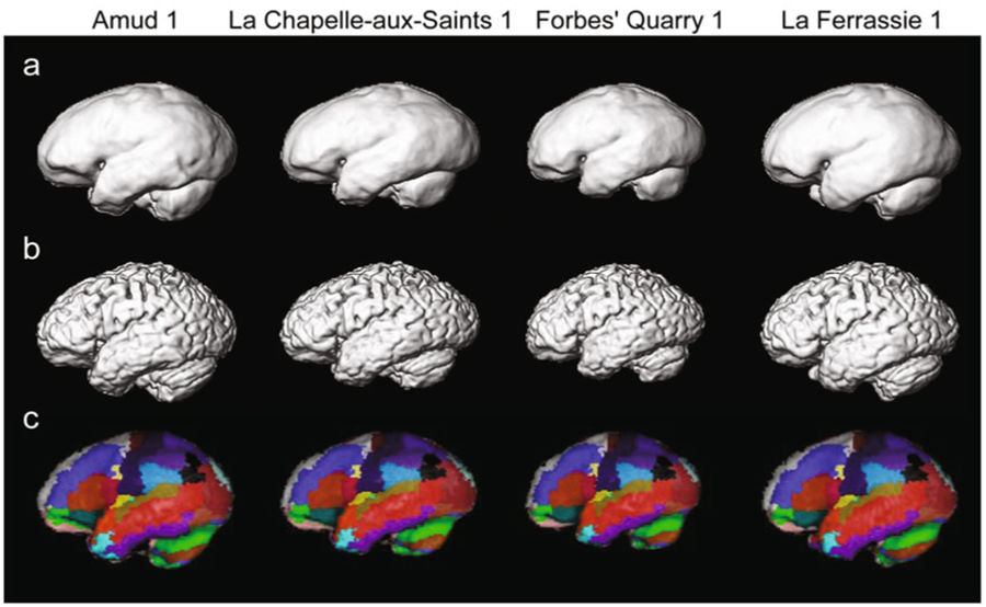 brains computational neuroanatomy