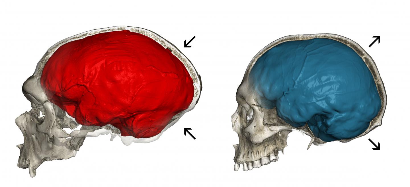 Neanderthal skull shape