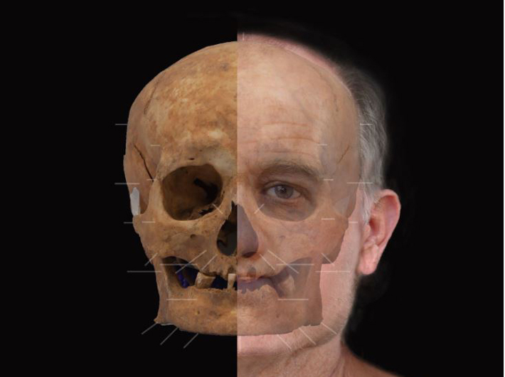 Scotland Facial Reconstruction