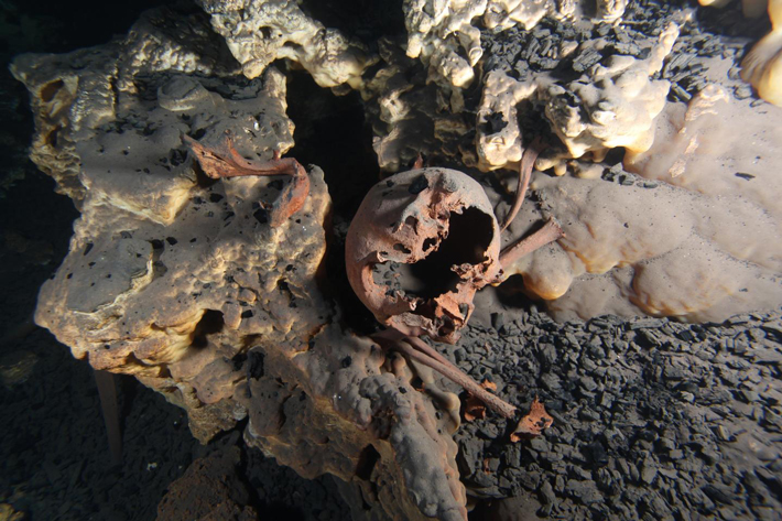 Mexico Skeletal Remains