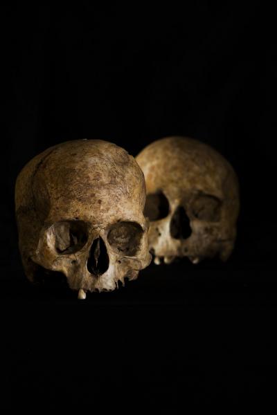 Spain Human Skull
