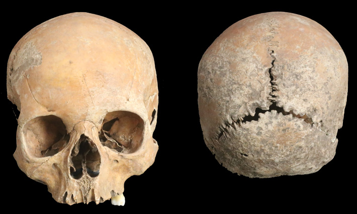 Anglo Saxon Skull