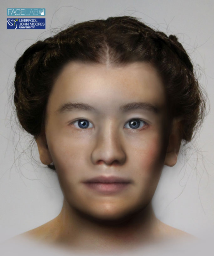 Norway Facial Reconstruction