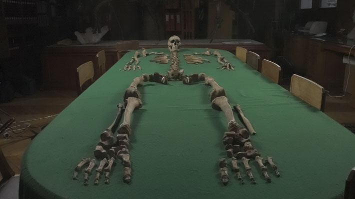 France Hunter Gatherer Skeleton