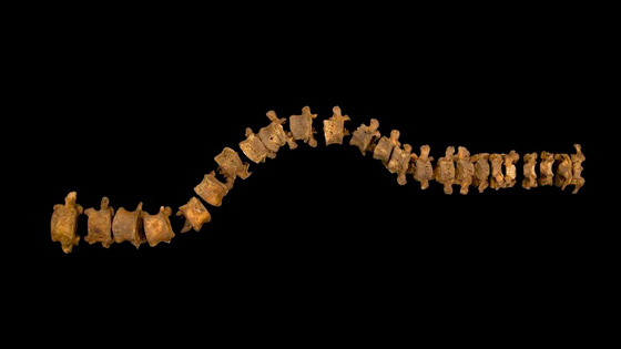 Richard III's complete spine is arranged here to show its exact curvature. (Courtesy University of Leicester)
